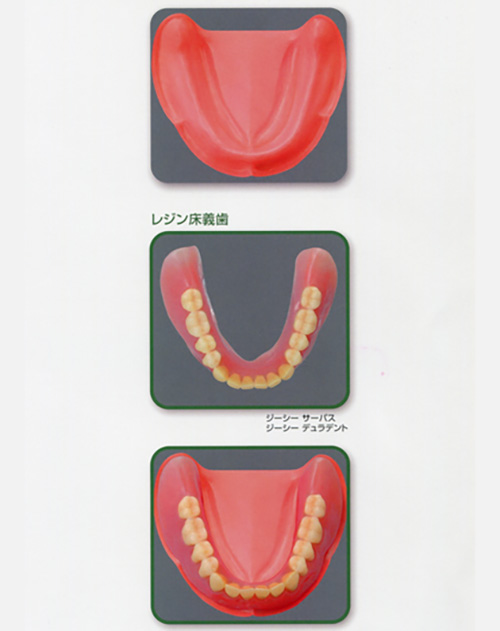 下顎総義歯